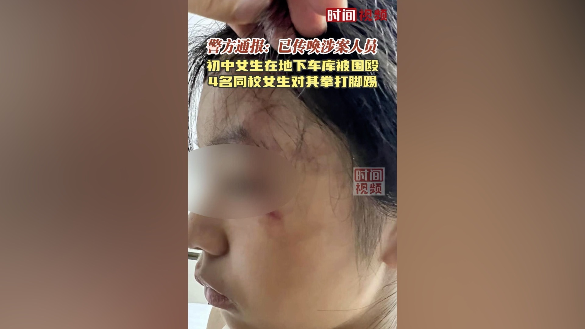 警方通报初中女生在地下车库被4名同校女生围殴:已传唤涉案人员 警方通报初中女生在地下车库被4名同校女生围殴:已传唤涉案人员