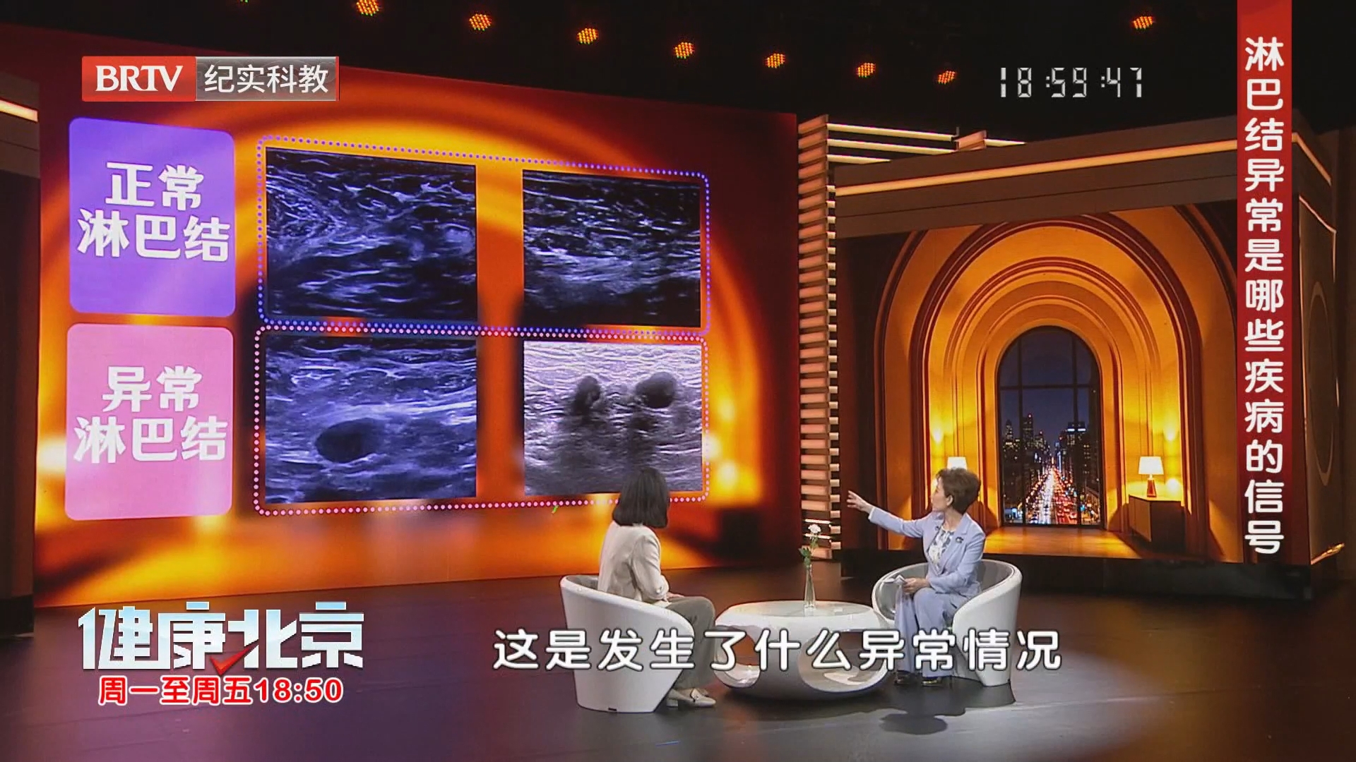淋巴结异常是哪些疾病的信号？