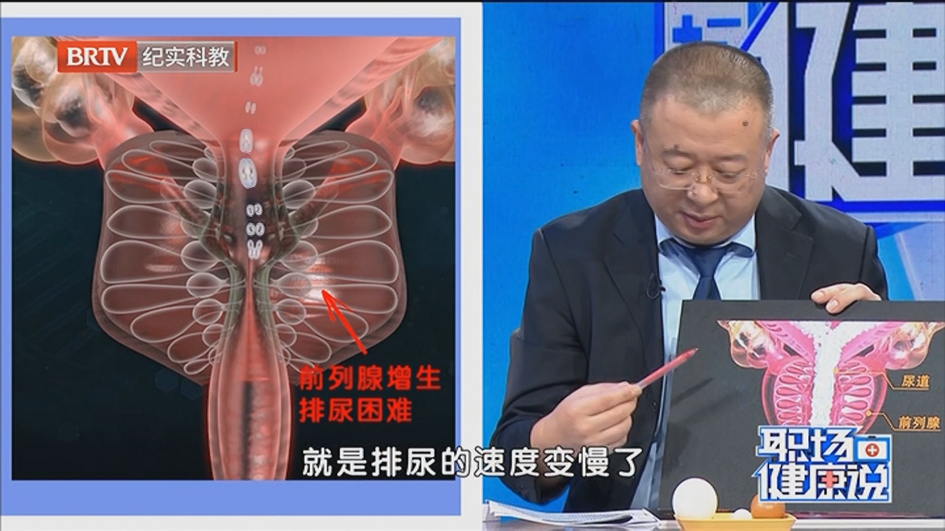 《职场健康说》20260224前列腺增生危害大 导致尿频 尿急 尿等待 尿不尽