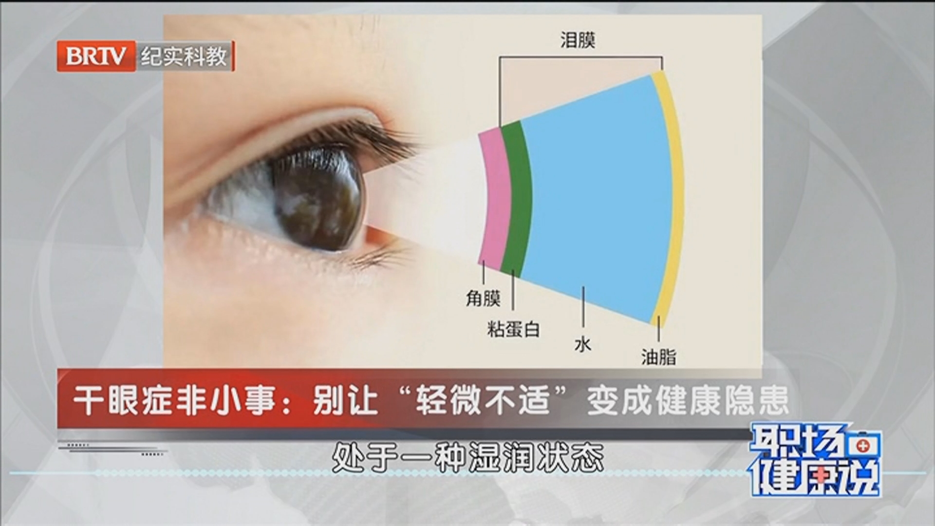 《职场健康说》20260526眼睛的小“干”扰——解码干眼症 《职场健康说》20260526眼睛的小“干”扰——解码干眼症