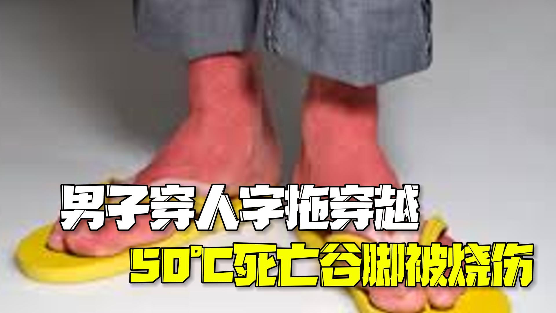 比利时游客穿人字拖穿越50℃死亡谷 鞋坏了就光脚走造成Ⅲ度烧伤