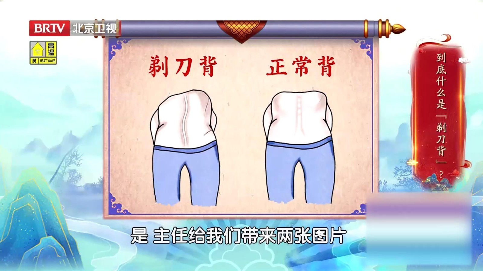 一个放松、弯腰的动作，发现“剃刀背”！