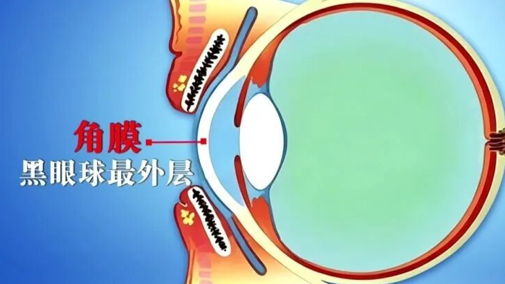 一个毁掉视力的习惯，你可能天天做，两个小动作帮你减少眼部损伤