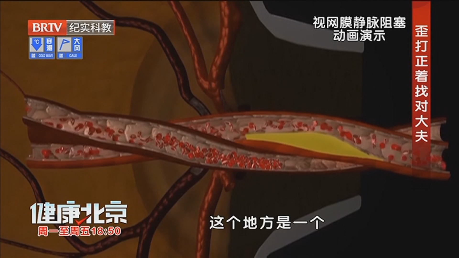 《健康北京》20260206眼睛“闹别扭”时要重视