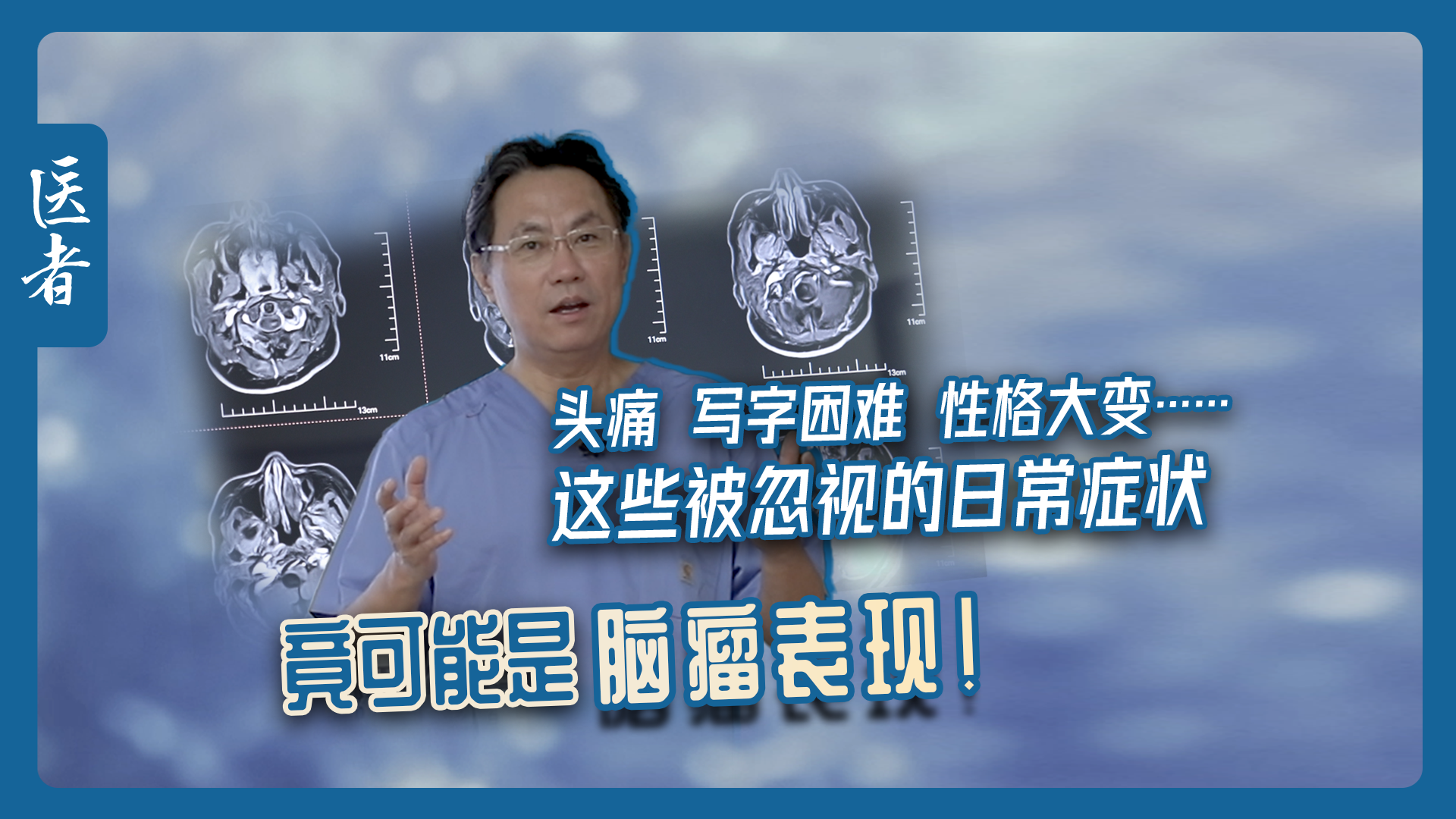 医者|头痛 写字困难 性格大变 这些被忽视的症状 竟可能是脑瘤表现 医者|头痛 写字困难 性格大变 这些被忽视的症状 竟可能是脑瘤表现