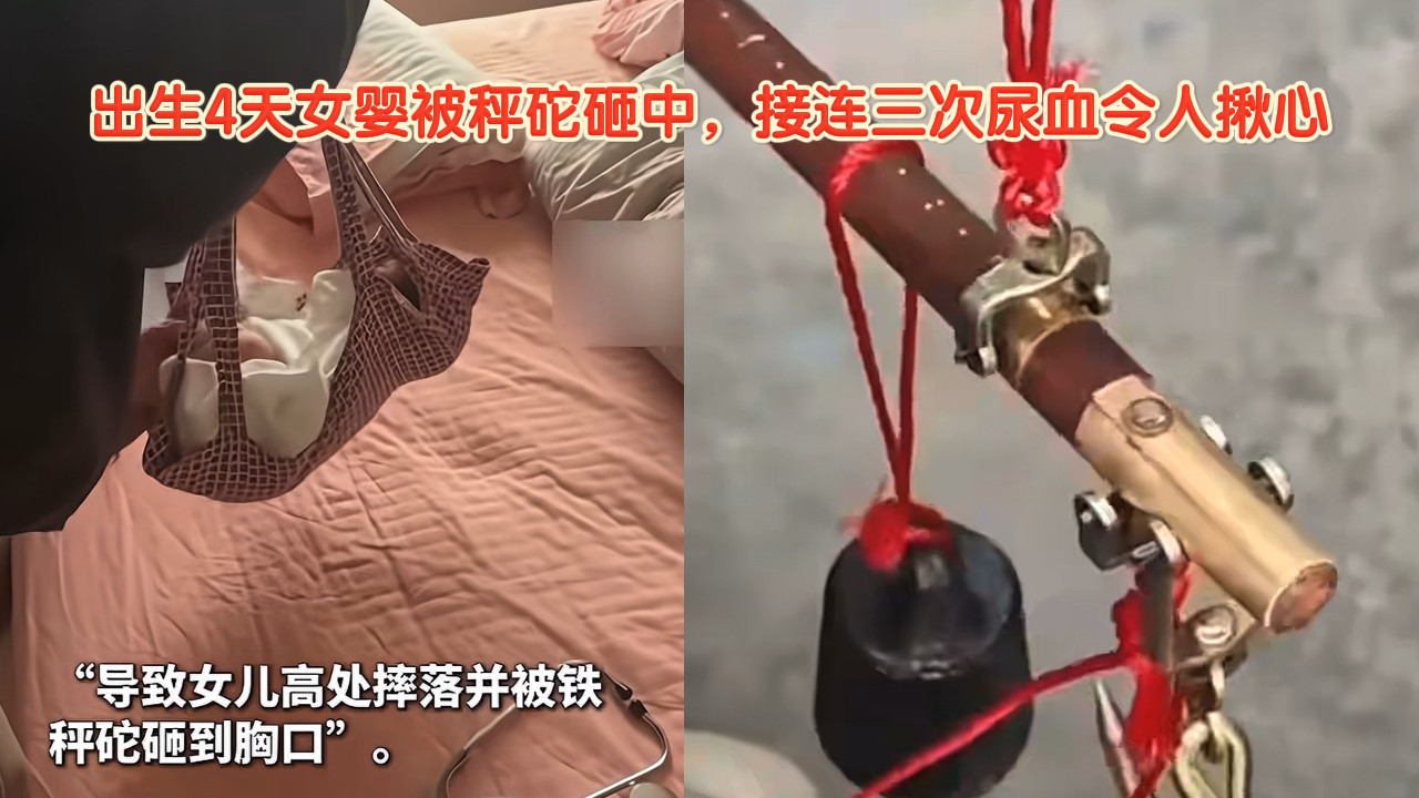 出生4天女婴被秤砣砸中，接连三次尿血令人揪心