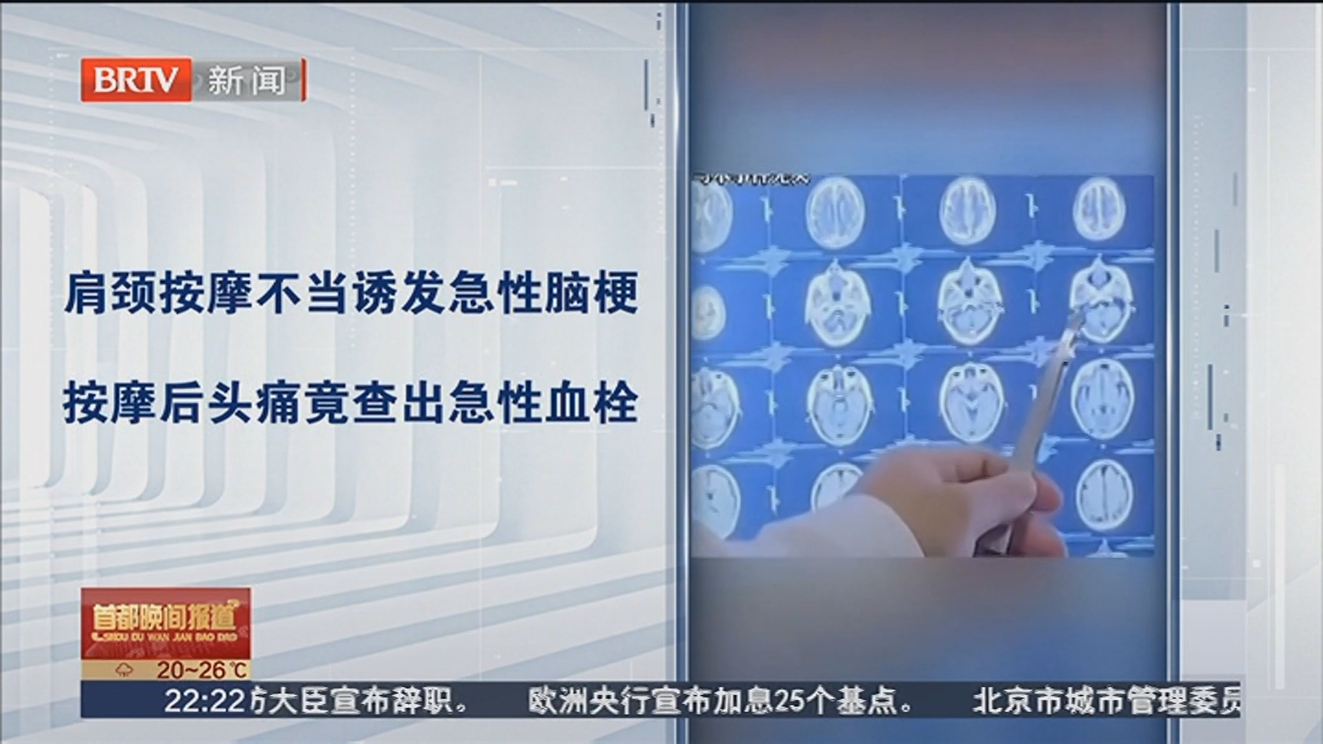 肩颈按摩不当诱发急性脑梗 按摩后头痛竟查出急性血栓
