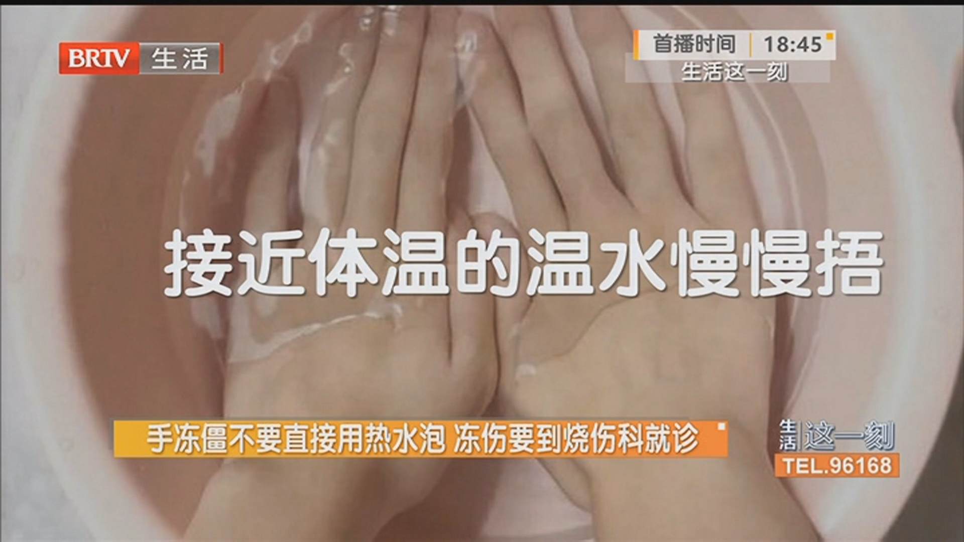 手冻僵不要直接用热水泡 冻伤要到烧伤科就诊