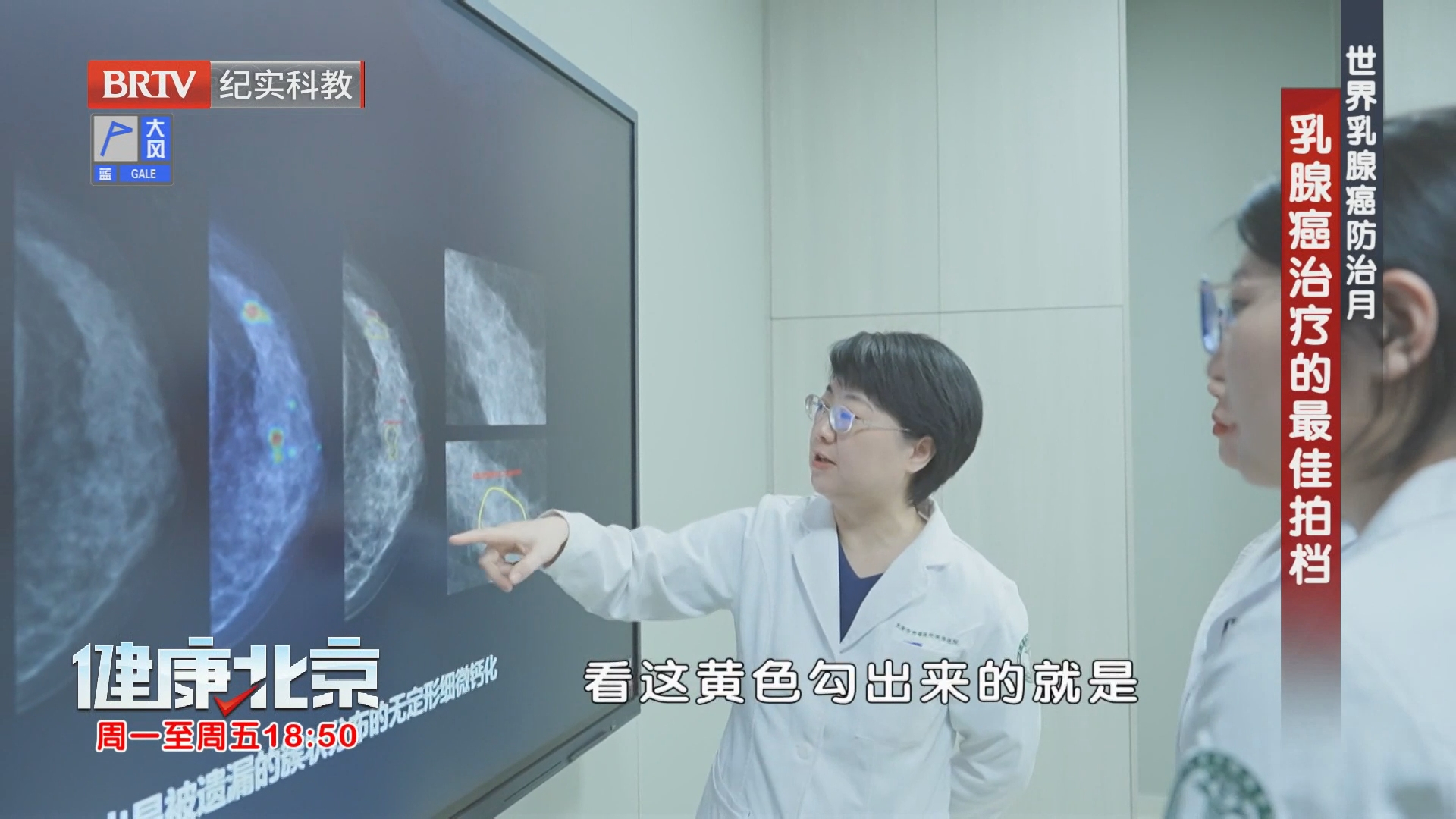乳腺癌治疗的最佳拍档（上）