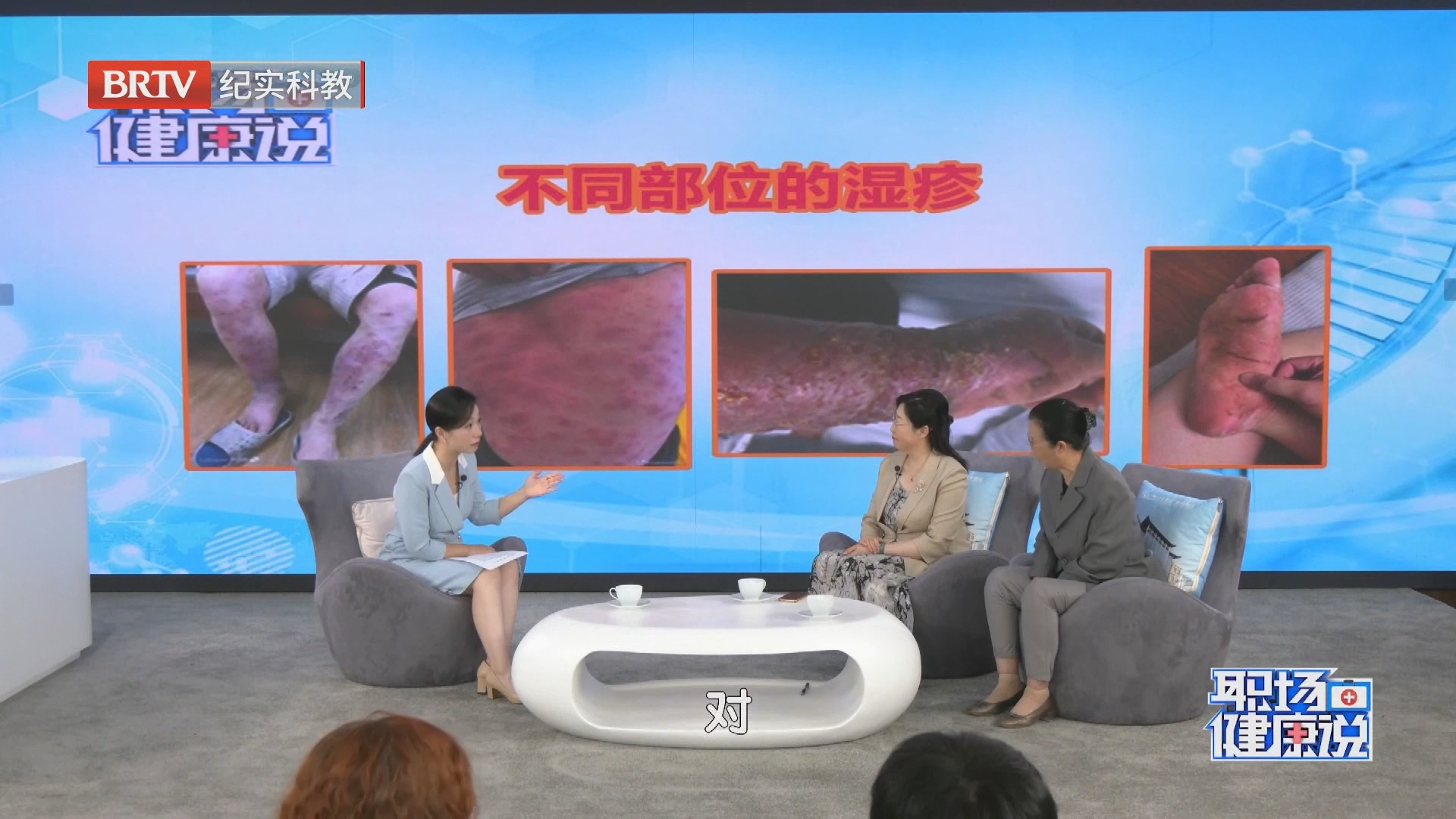 《职场健康说》20260928手脚湿疹VS全身湿疹 破解瘙痒困局！
