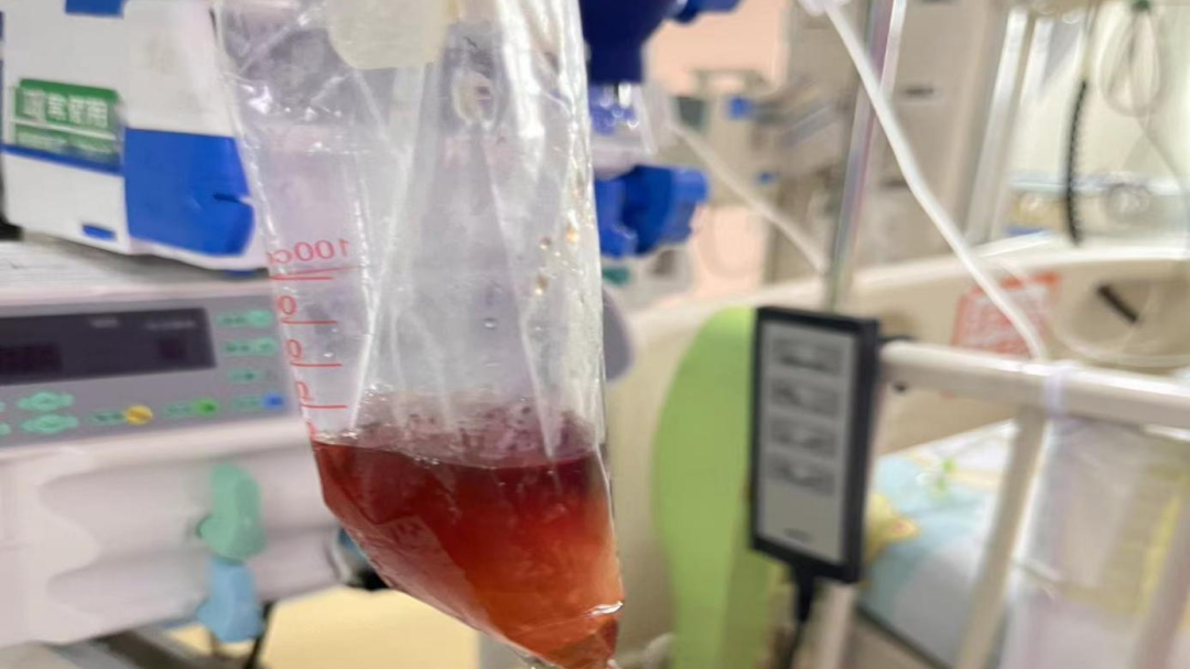 吃了一包零食，5岁娃进了ICU！这些人最易被这种恶疾“盯上”