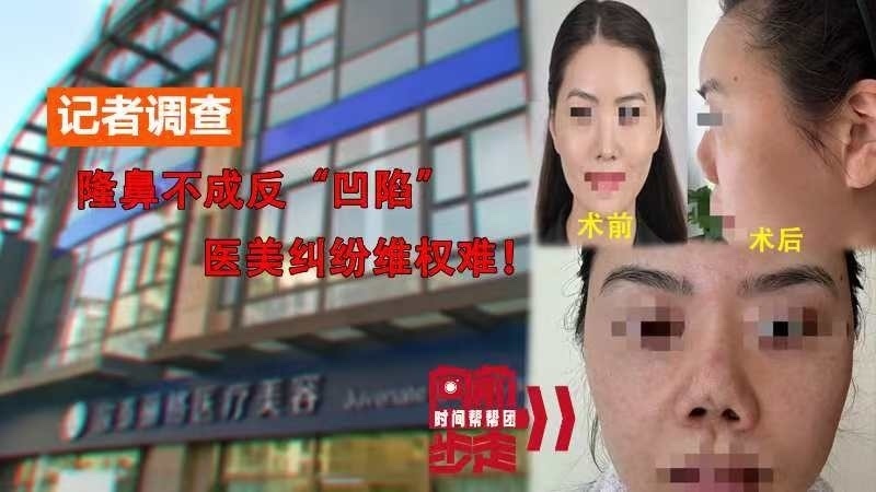 记者调查：隆鼻不成反“凹陷” 医美纠纷维权难