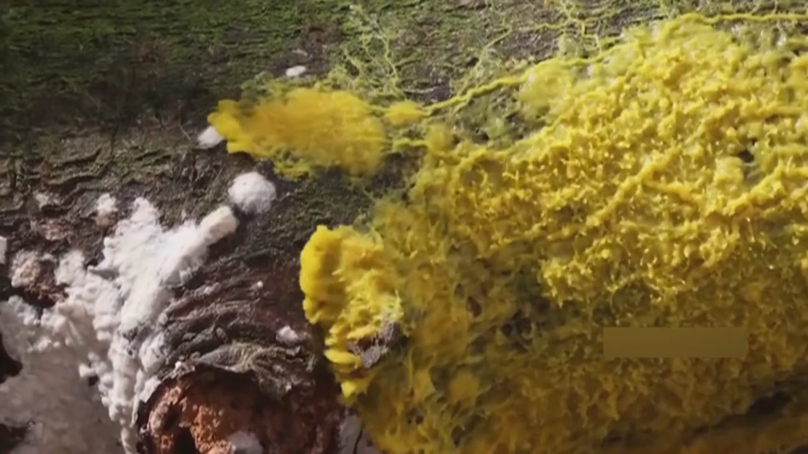 医生提醒:谨防霉菌性肺炎 医生提醒:谨防霉菌性肺炎