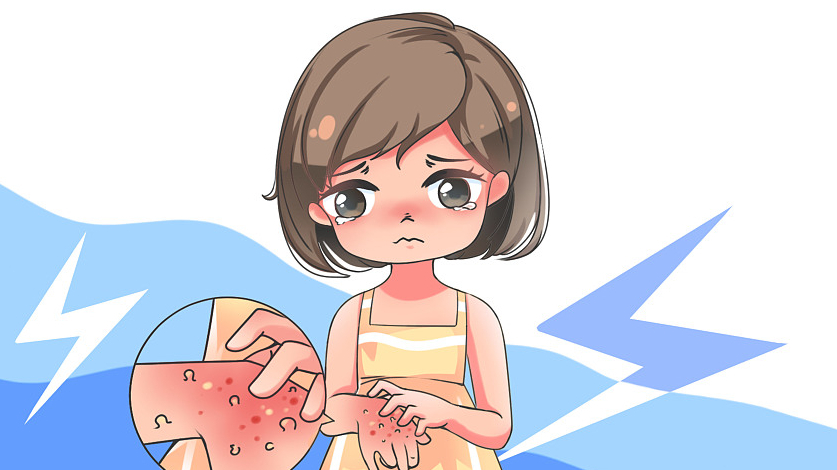 今日科普：“桑拿天”警惕夏季皮肤病