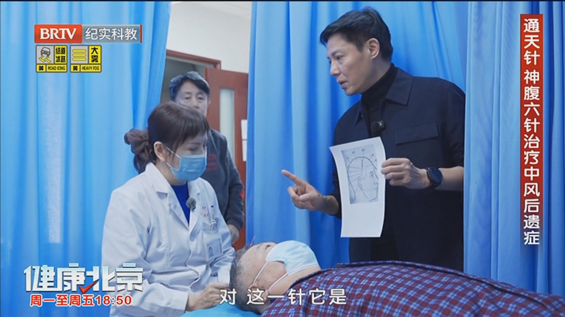 《健康北京》20260304沉浸式体验中医针灸治疗