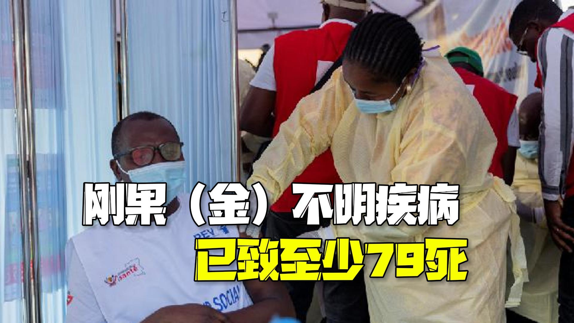 刚果（金）爆发不明疾病至少79人死亡：多为15岁以上青少年