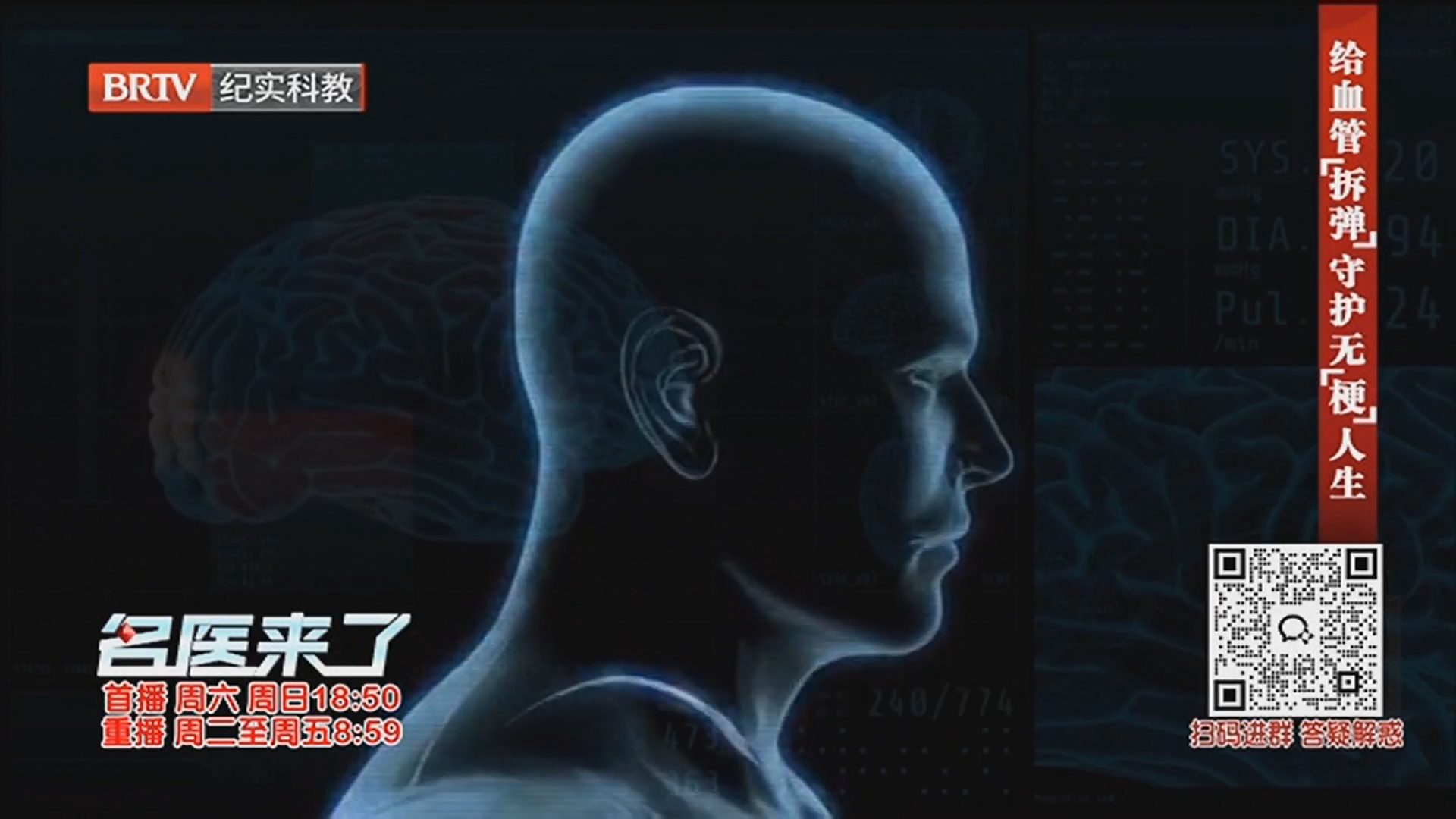 《名医来了》20260314给血管“拆弹” 守护无“梗”人生