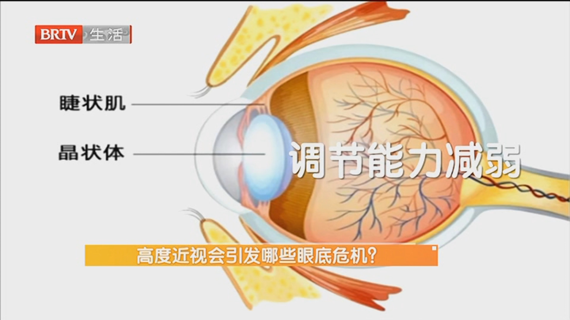 70多岁老人长期刷手机 近视高达2300度 高度近视会引发哪些眼底危机？老年人刷手机 该如何保护眼健康？