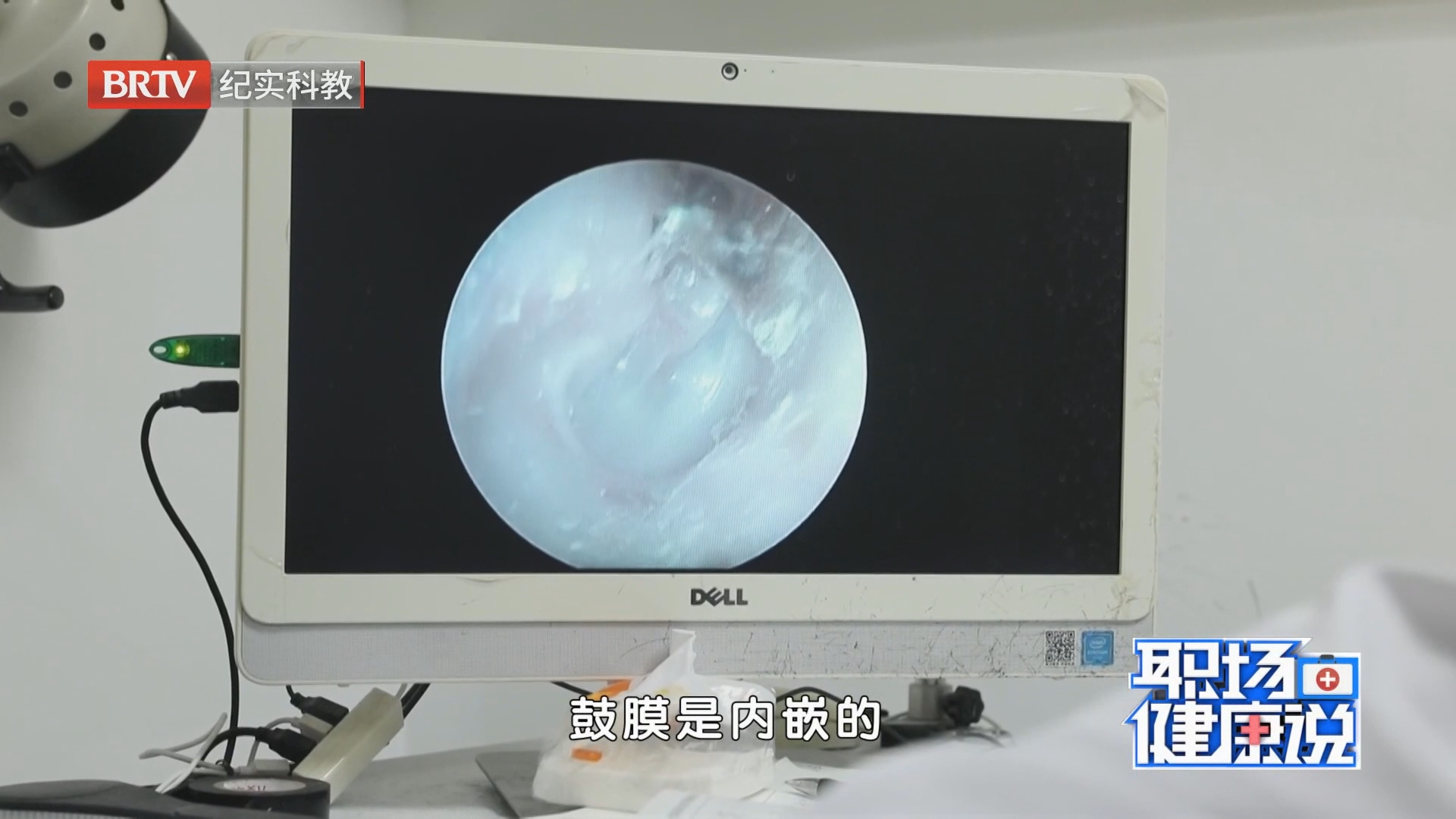 《职场健康说》20260907耳鸣 “困在不存在的噪音里”