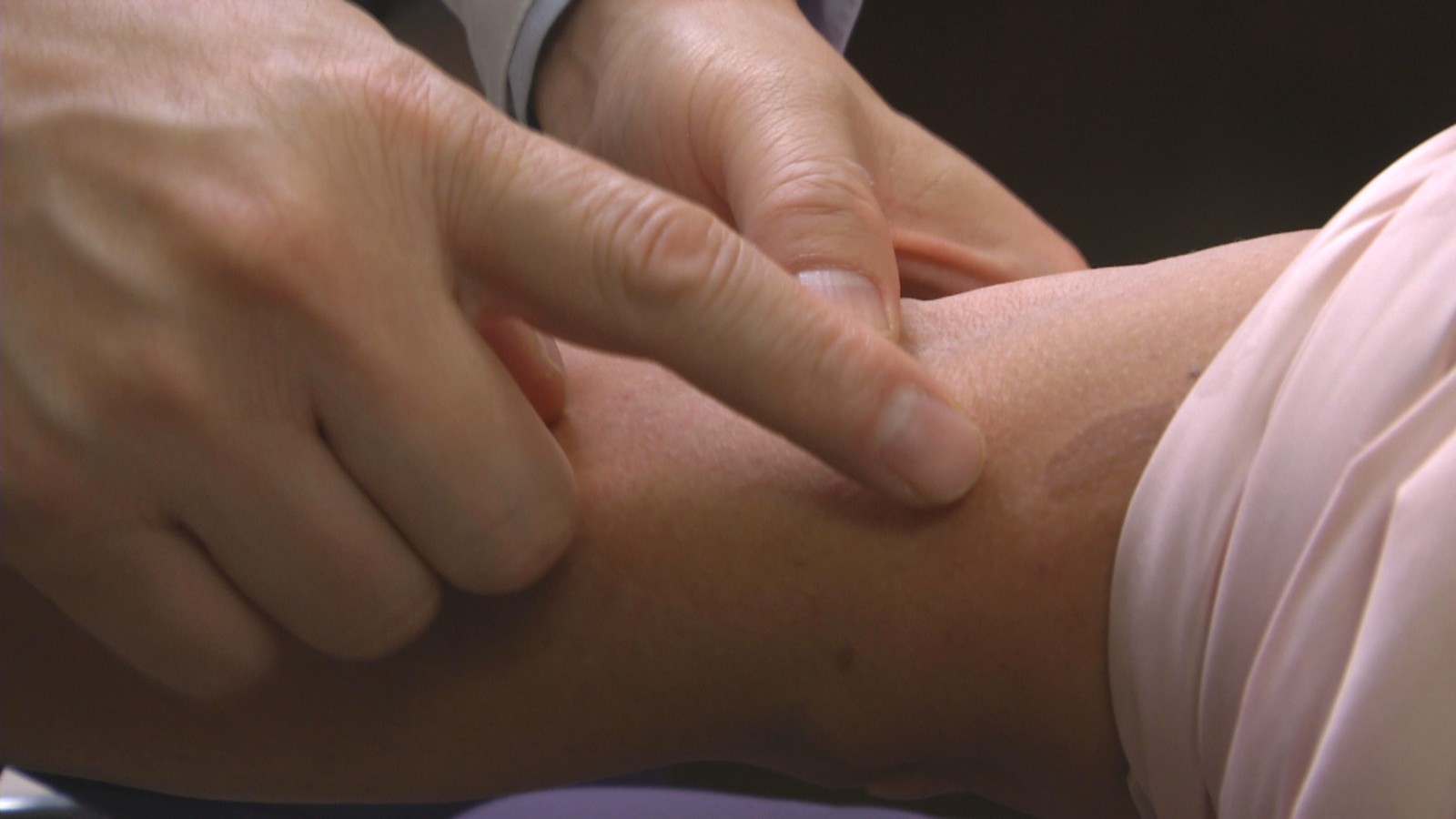 神经纤维瘤病:全生命周期管理帮助患者长期生存 神经纤维瘤病:全生命周期管理帮助患者长期生存