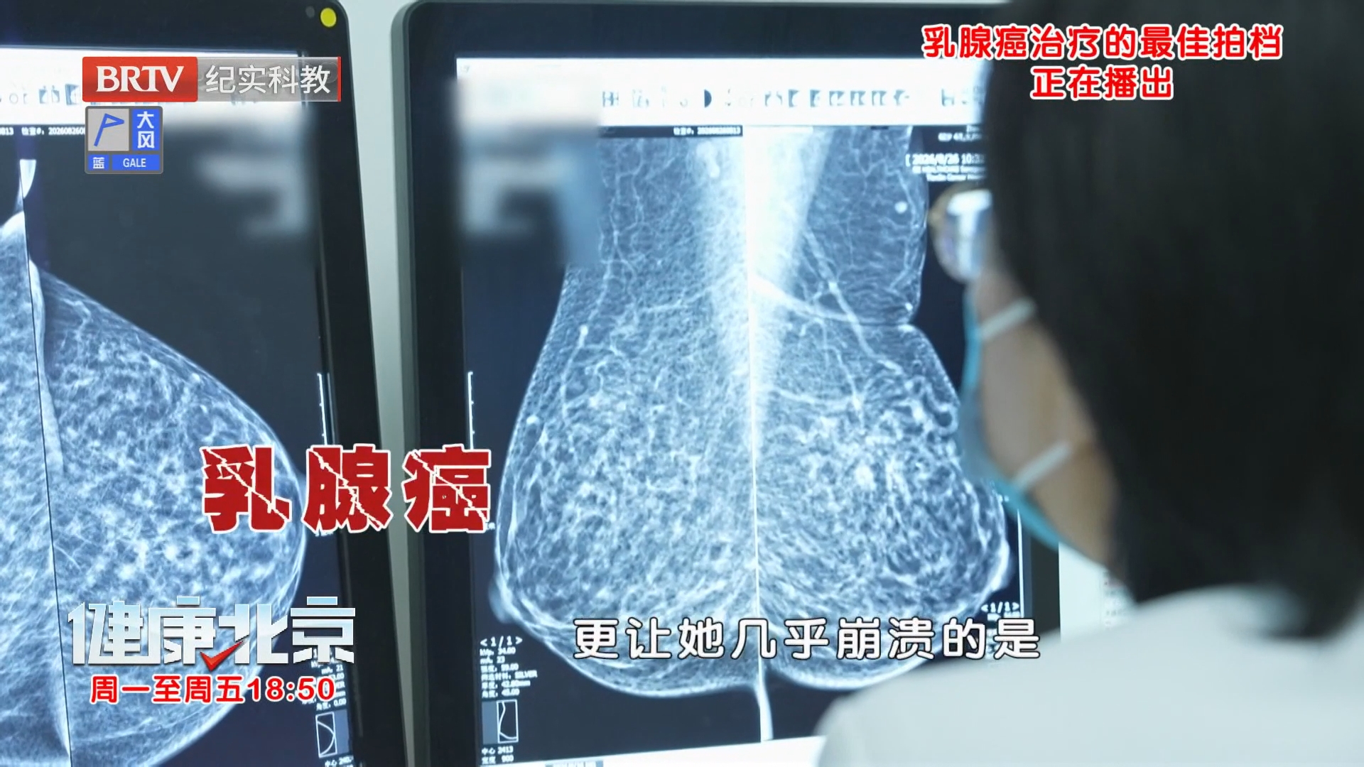 《健康北京》20260929世界乳腺癌防治月 乳腺癌治疗的最佳拍档 《健康北京》20260929世界乳腺癌防治月 乳腺癌治疗的最佳拍档