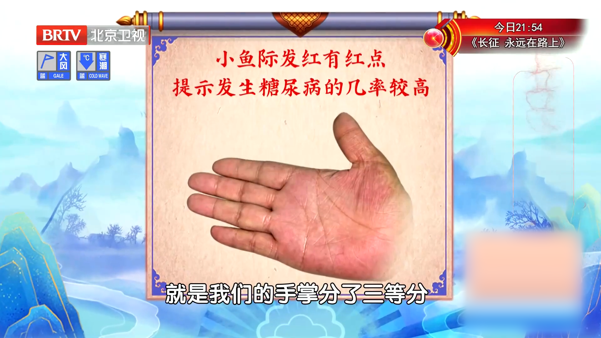 手掌的颜色竟能反映身体状况！小鱼际发红，提示下焦有虚热