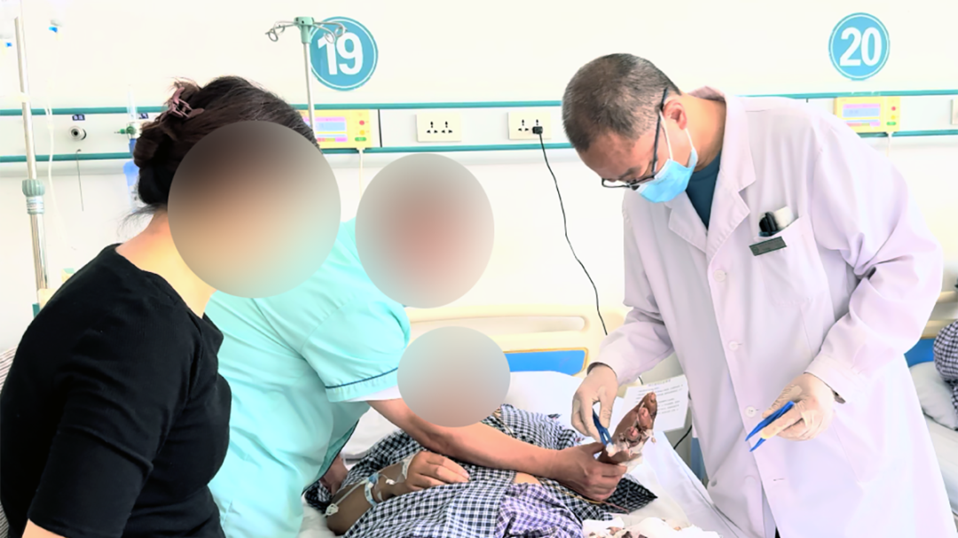 三指离断、辗转求医,顺义这家医院让他重获希望 三指离断、辗转求医,顺义这家医院让他重获希望