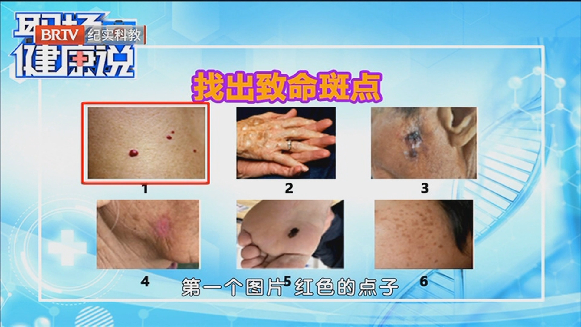 《职场健康说》20260421皮肤上出现异常斑点需警惕