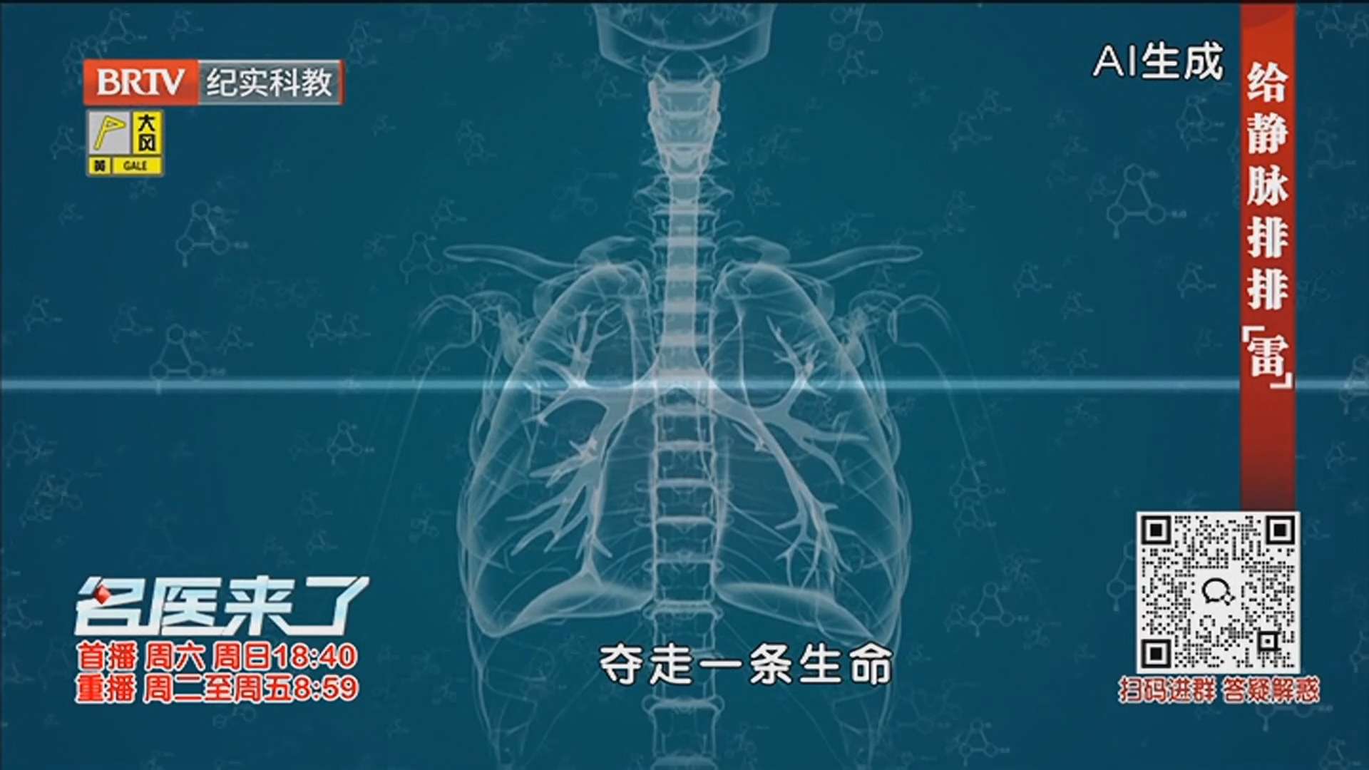 《名医来了》20260426给静脉排排“雷”