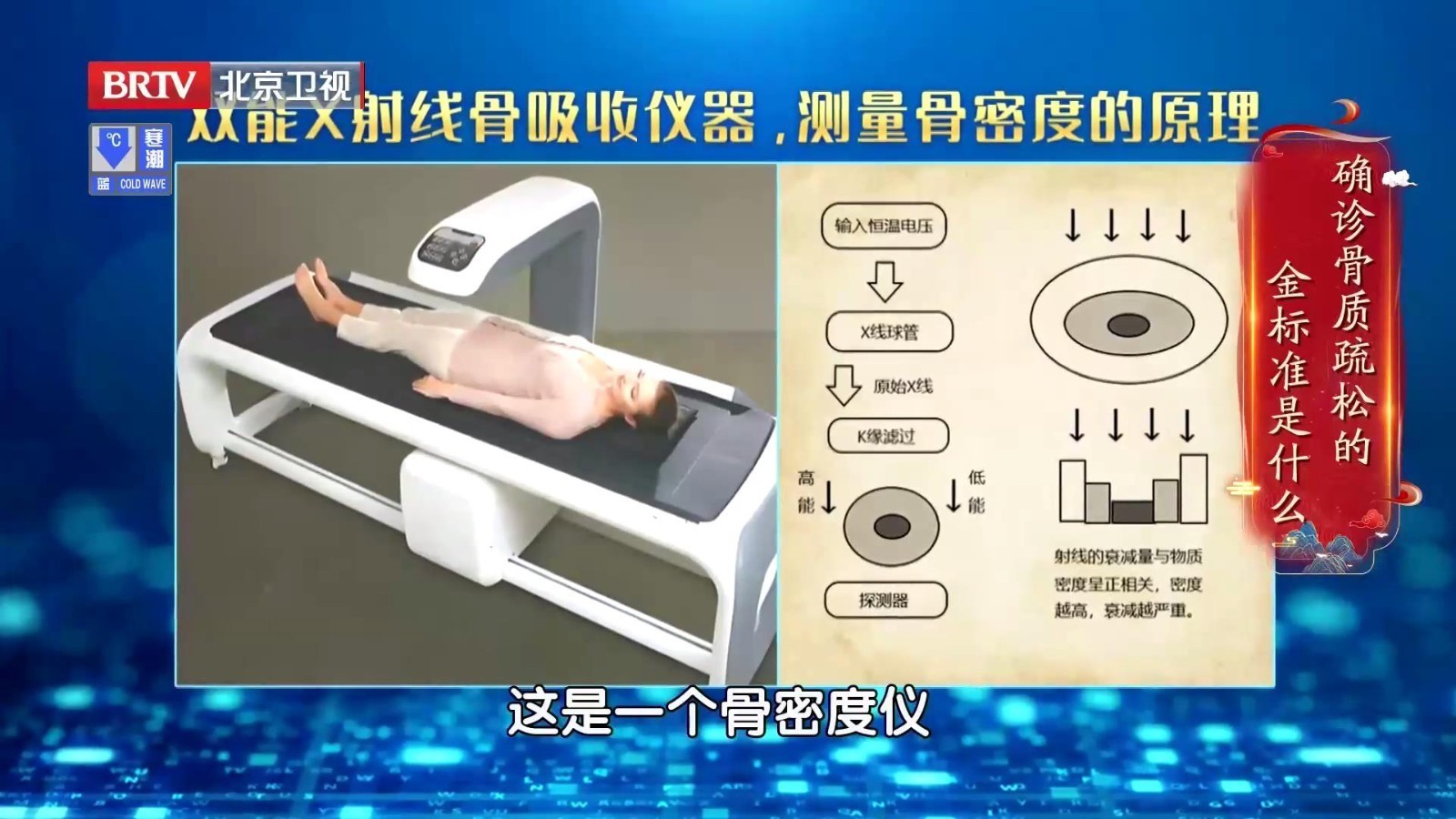 骨密度检测：确诊骨质疏松的金标准