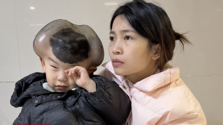 福建3岁男童患先天性巨痣，琪宝妈妈：孩子一直担心家人会离开他