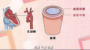 主动脉夹层近期呈高发趋势 这4类人群要警惕