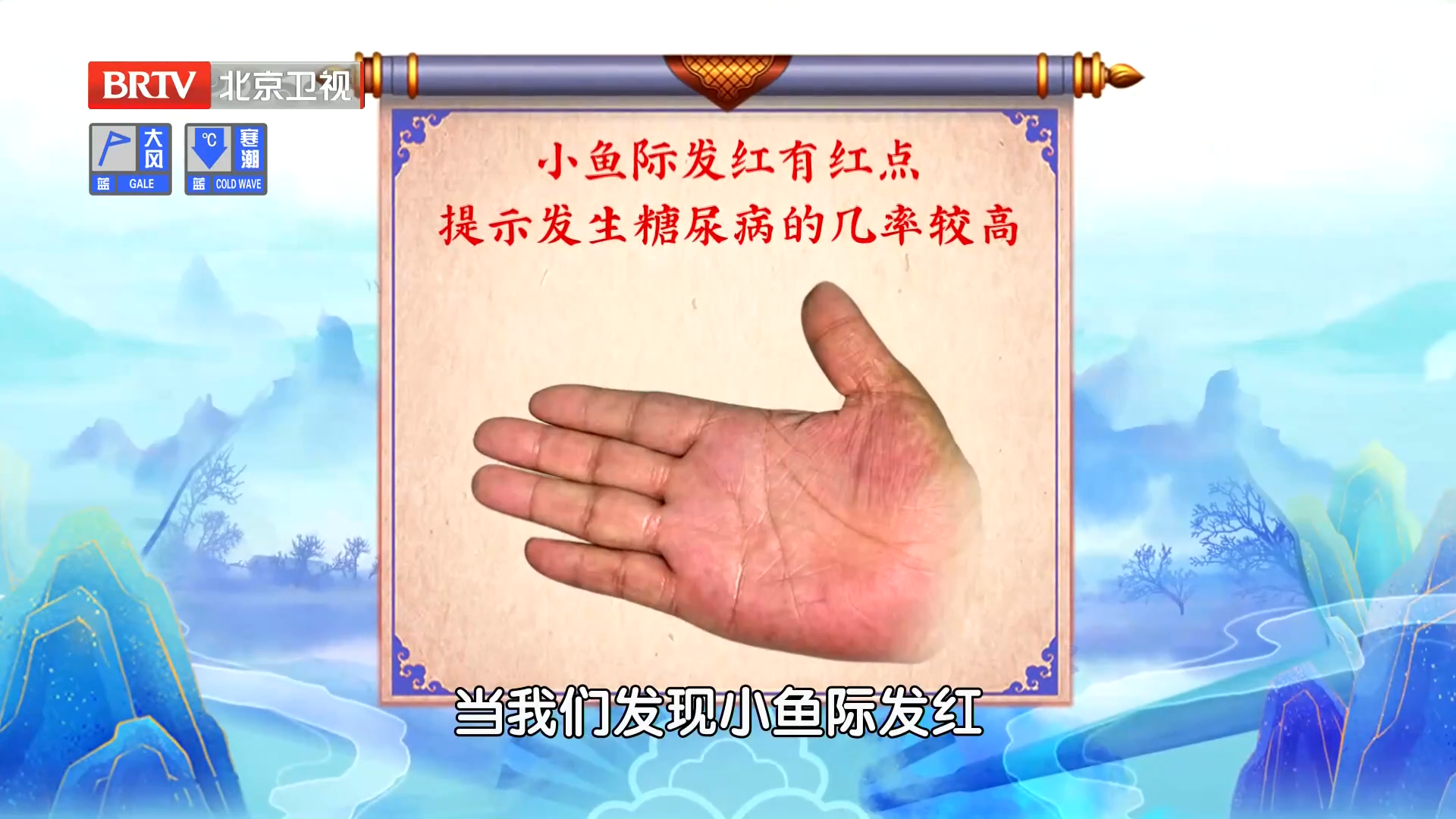 小鱼际发红或有红点，发生糖尿病的几率较高！